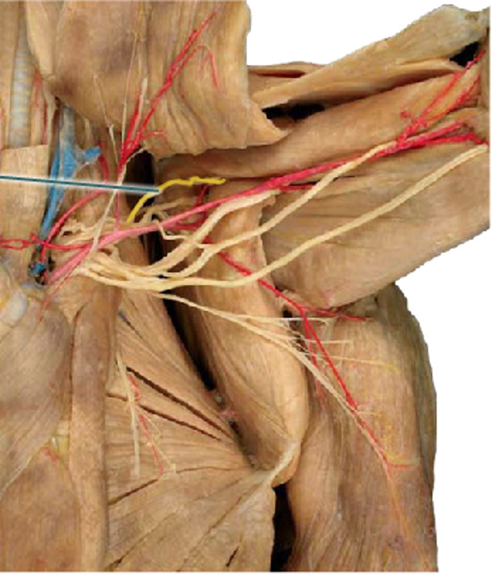 <p>What is the name of the yellow highlighted nerve?</p>