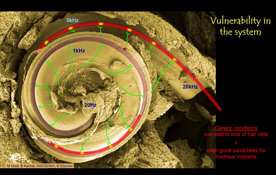 <p><span>They bypass lost hair cells by directly stimulating the auditory nerve with electrical signals, preserving tonotopic coding along the cochlea.</span></p>