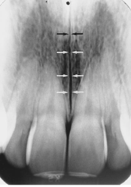 <p>identify the sucture</p>
