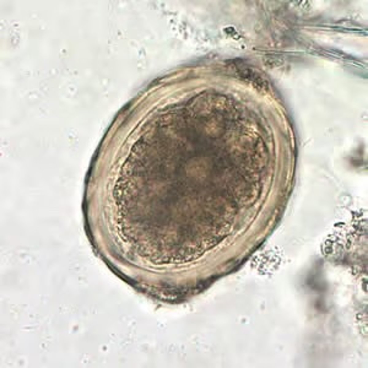 <p>Thick shell with no gap</p>