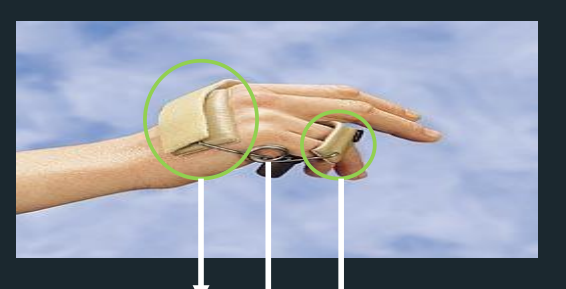 <p>Dynamic Ulnar Nerve Splint - Parts </p>
