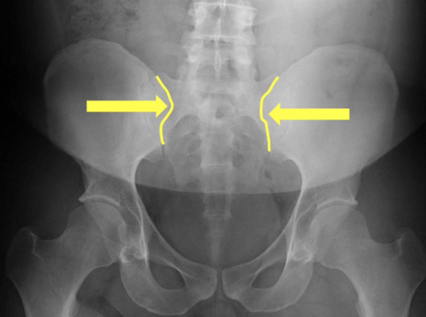 <p>What are the yellow arrows pointing to?</p>