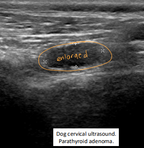 <p><span style="background-color: transparent;"><strong>Primary Hyperparathyroidism</strong></span></p>