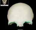 <p>The superior rim of the eye socket located on the frontal bone.</p>