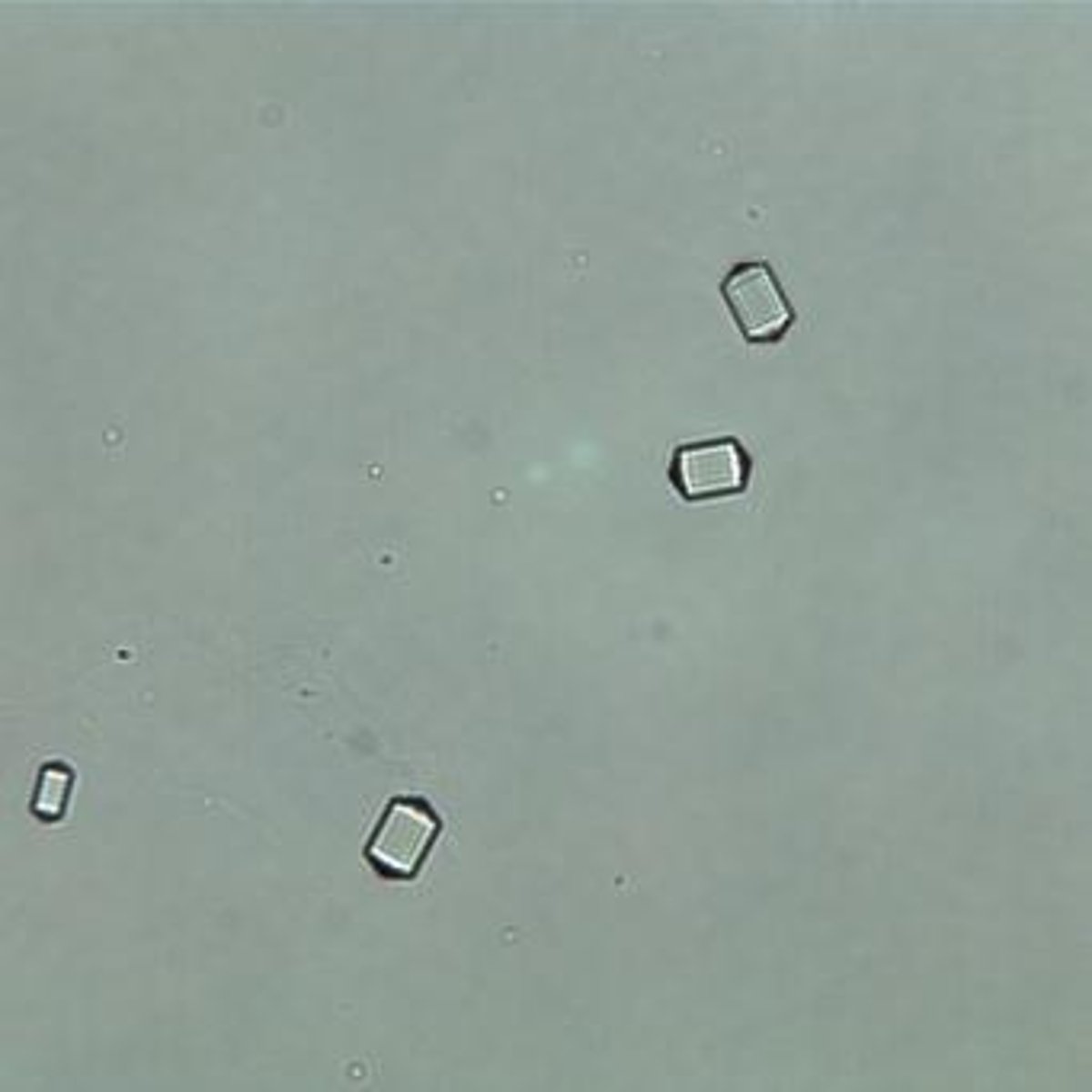 <p>Calcium Oxalate Crystals.</p>