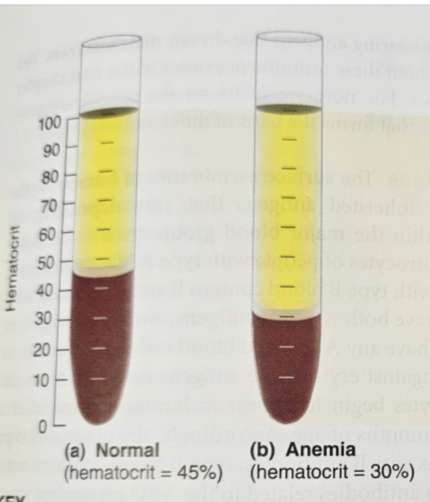 <p>decreased hematocrit</p><ul><li><p>normal erythrocyte count (hematocrit) is 45%</p></li></ul><p>CAUSE DECREASE IN O2 and PERFUSION</p><p></p>