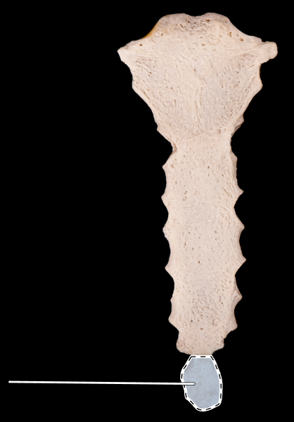 <p>What is the highlighted section called?</p><p>(Sternum, anterior view).</p>