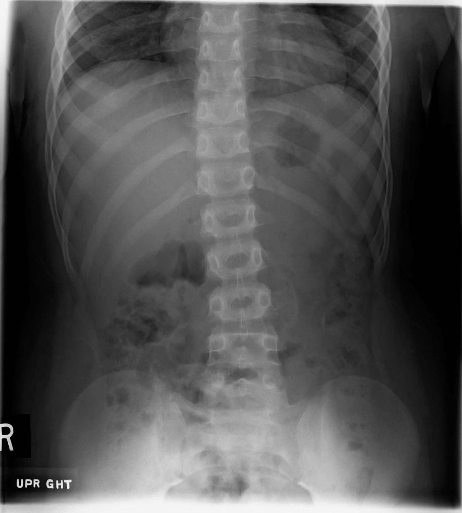 <p>From T8 (including diaphragms) to the sacrum, including bilateral flank stripes.</p>