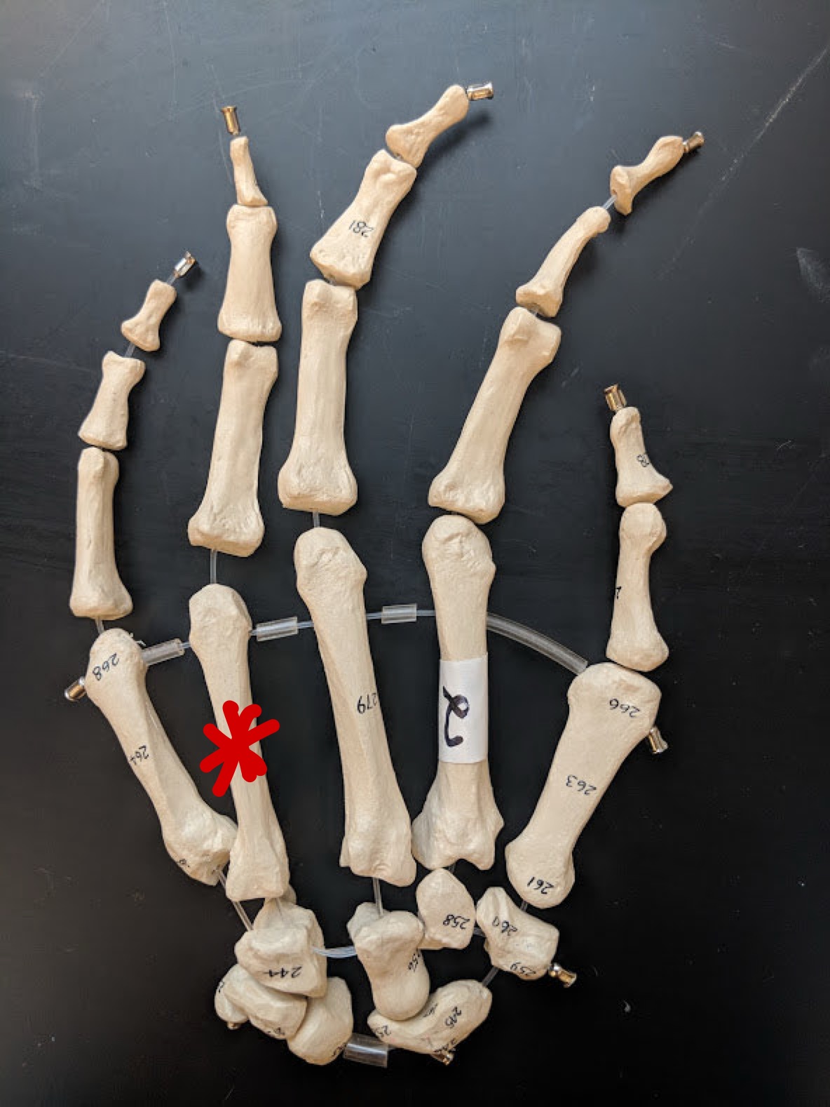 <p>Name this bone</p>