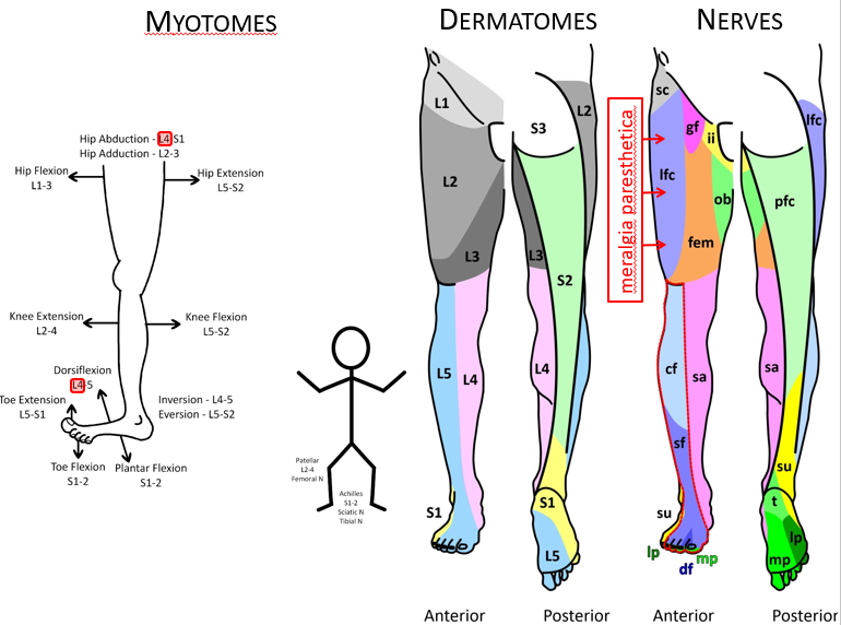 <p><span>•</span><span style="font-family: &quot;Bodoni MT&quot;">L1 nerve root: Exits between L1 and L2 foramina, innervates iliopsoas muscle, sensory distribution: upper third thigh, assessed with the cremasteric reflex (male).</span></p><p></p><p><span>•</span><span style="font-family: &quot;Bodoni MT&quot;">L2 nerve root:&nbsp;Exits between L2 and L3 foramina, innervates iliopsoas muscle, hip adductor, and quadriceps, sensory distribution: middle third thigh, no reflex.</span></p><p></p><p><span>•</span><span style="font-family: &quot;Bodoni MT&quot;">L3 nerve root:&nbsp;Exits between L3 and L4 foramina, innervates iliopsoas muscle, hip adductor, and quadriceps, sensory distribution: lower third thigh, no reflex.</span></p>