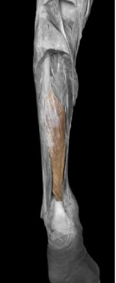 <p>Flexor hallucis longus </p>