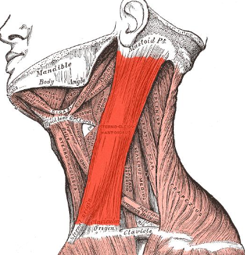 <p>SternoCleidoMastoid </p>