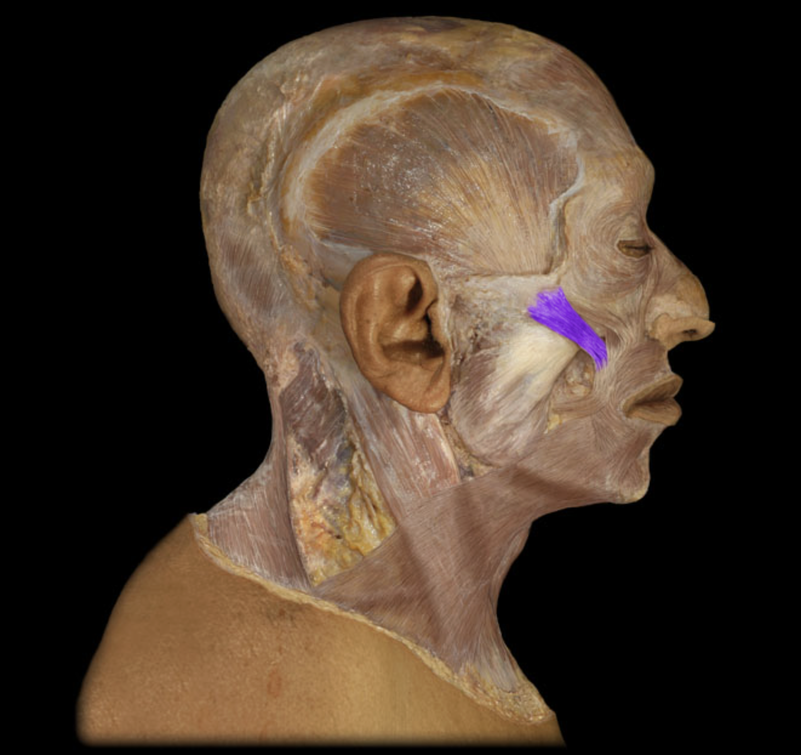 <p>What muscle is this?</p>