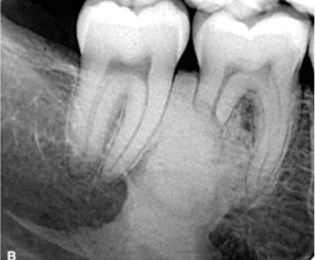 <p>most likely diagnosis?</p>