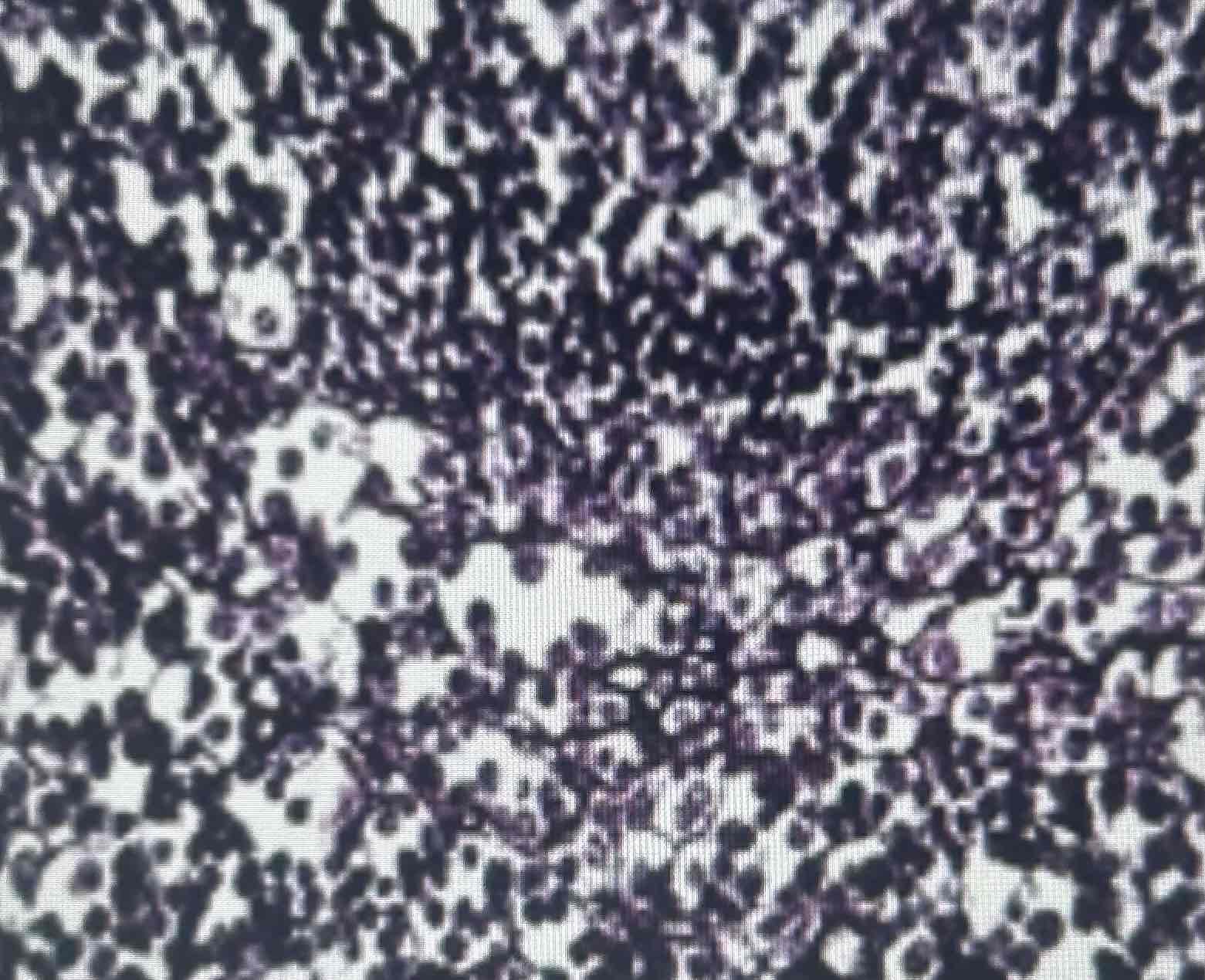 <p>Reticular</p>