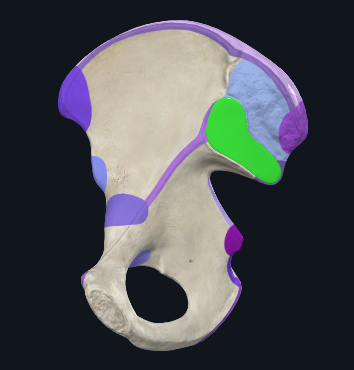 term image