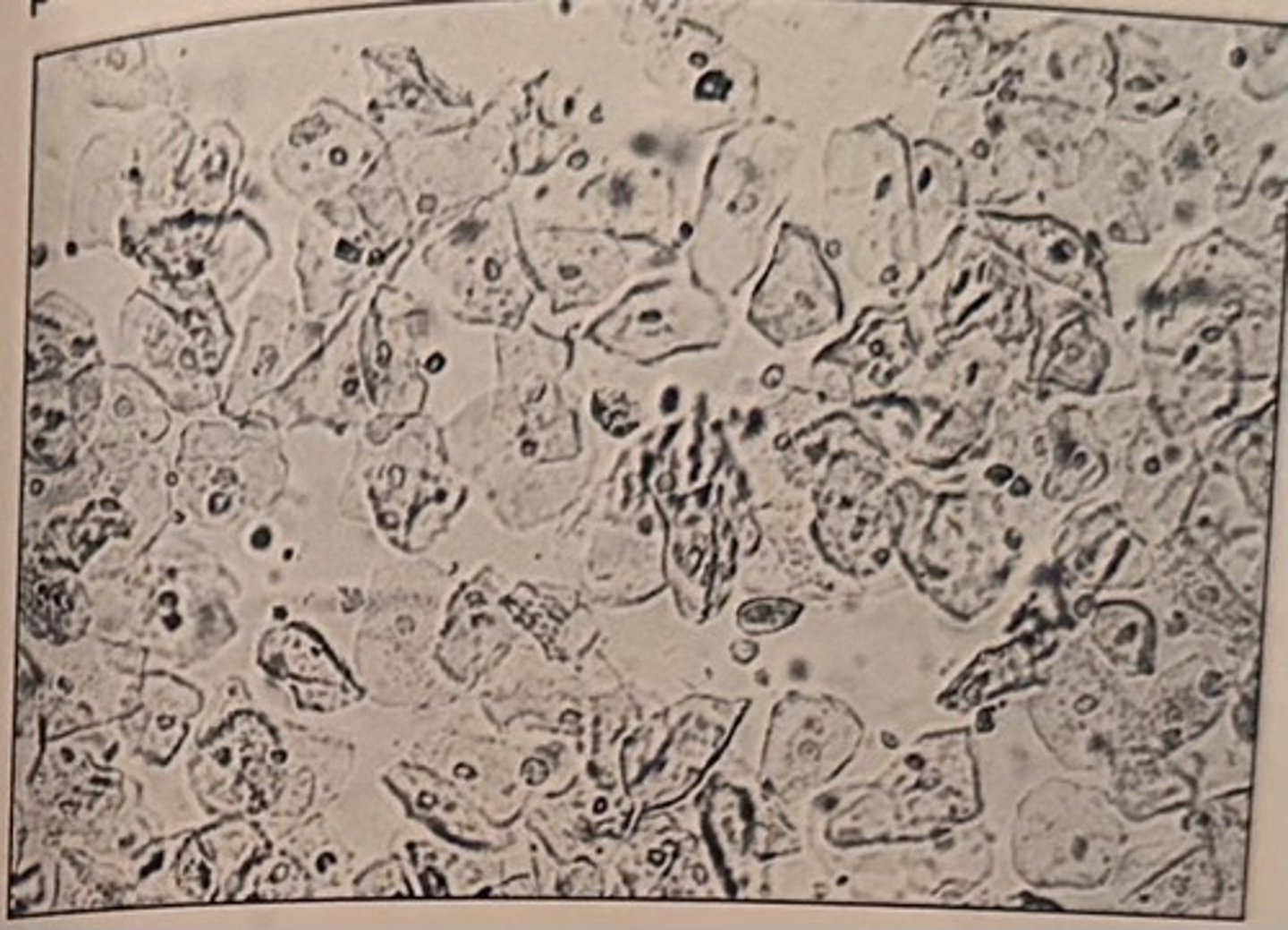 <p>a. contamination</p>