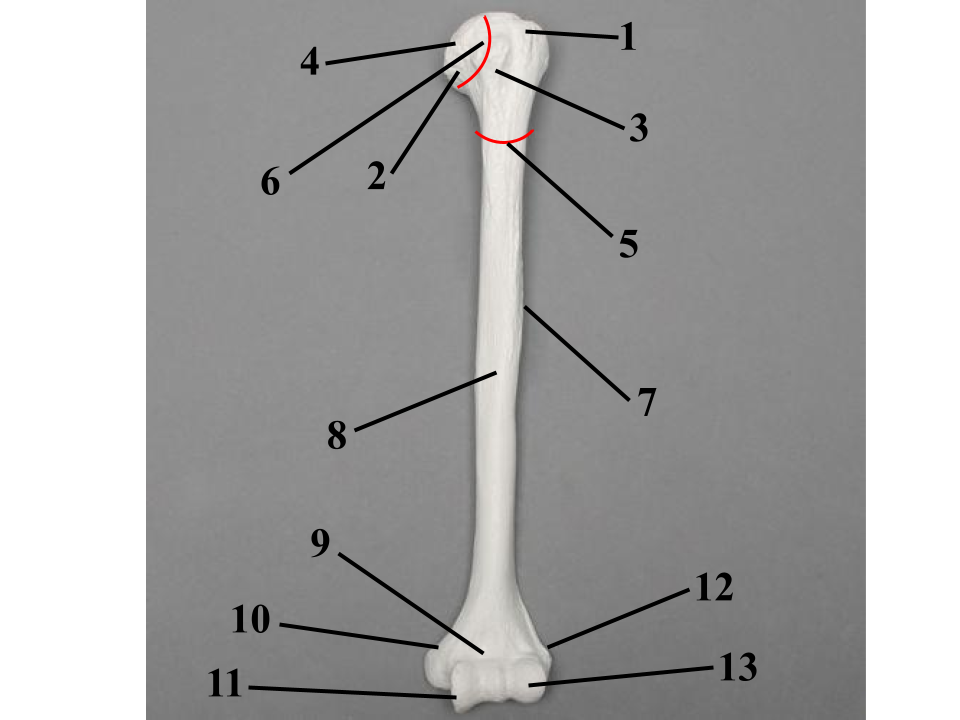 <p>What structure is indicated by 13?</p>