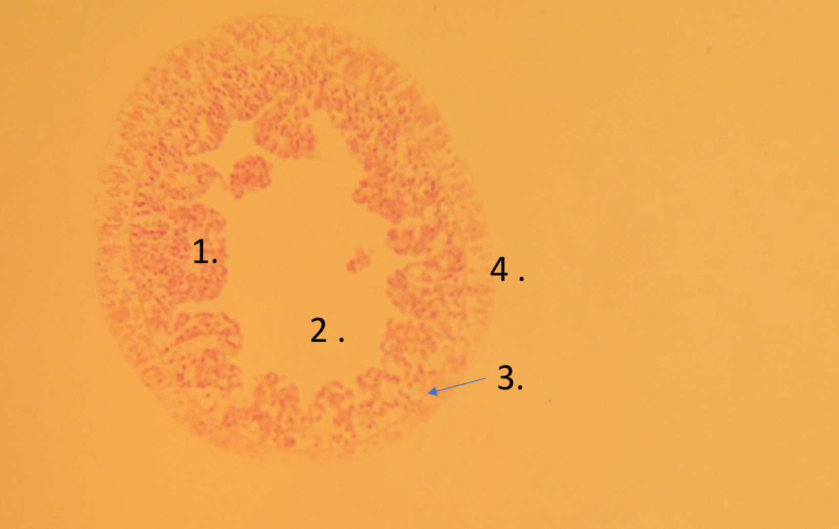 <p>What is 4 </p>