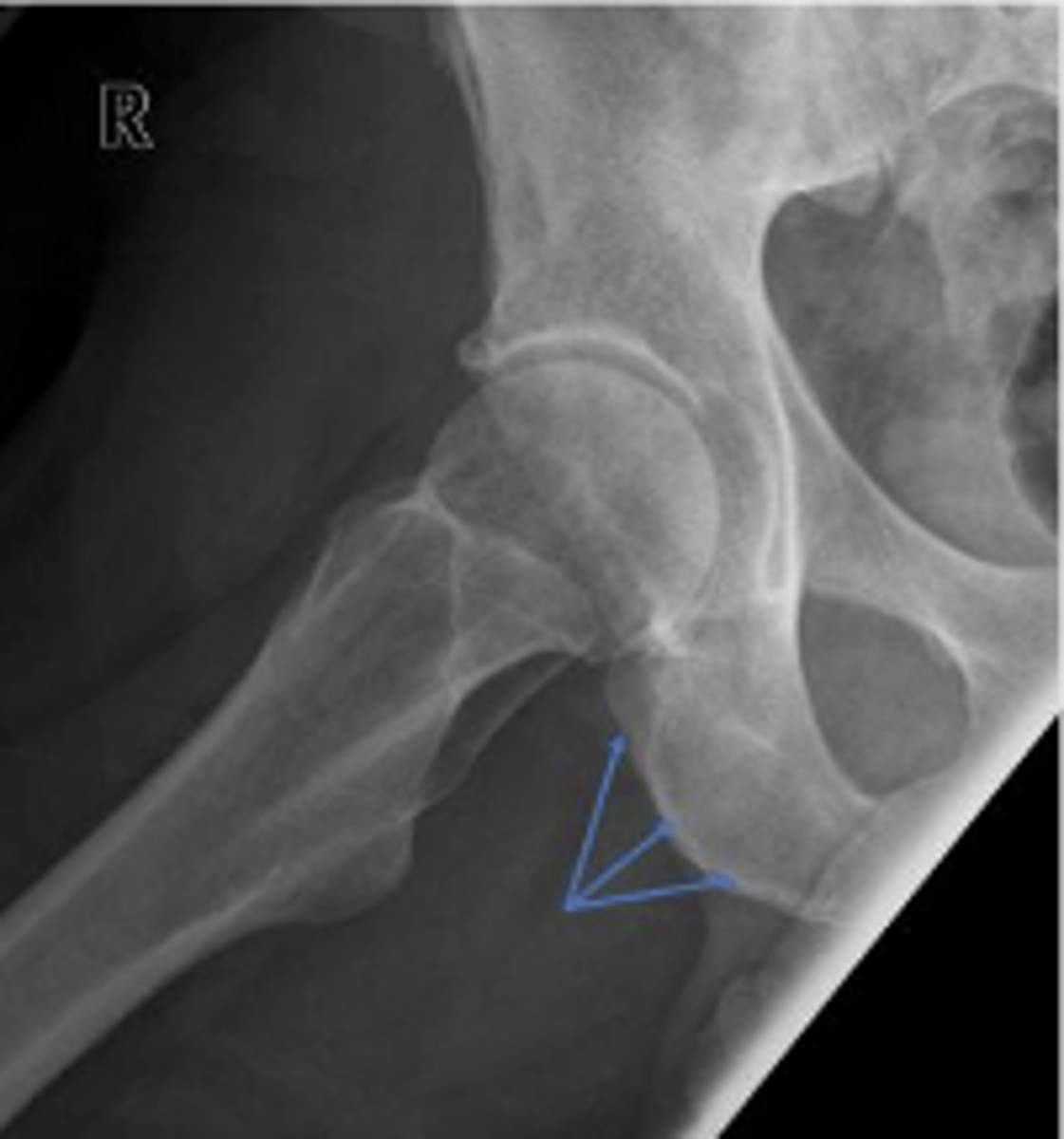 <p>What are the arrows pointing to?</p>