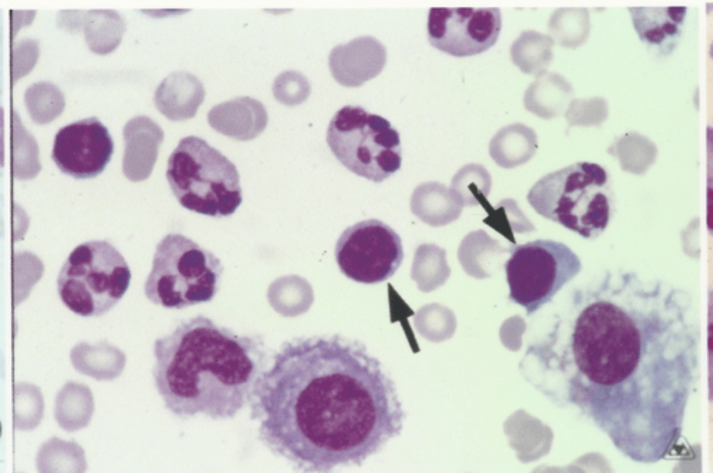 <p>Identify the cells in this body fluid</p>