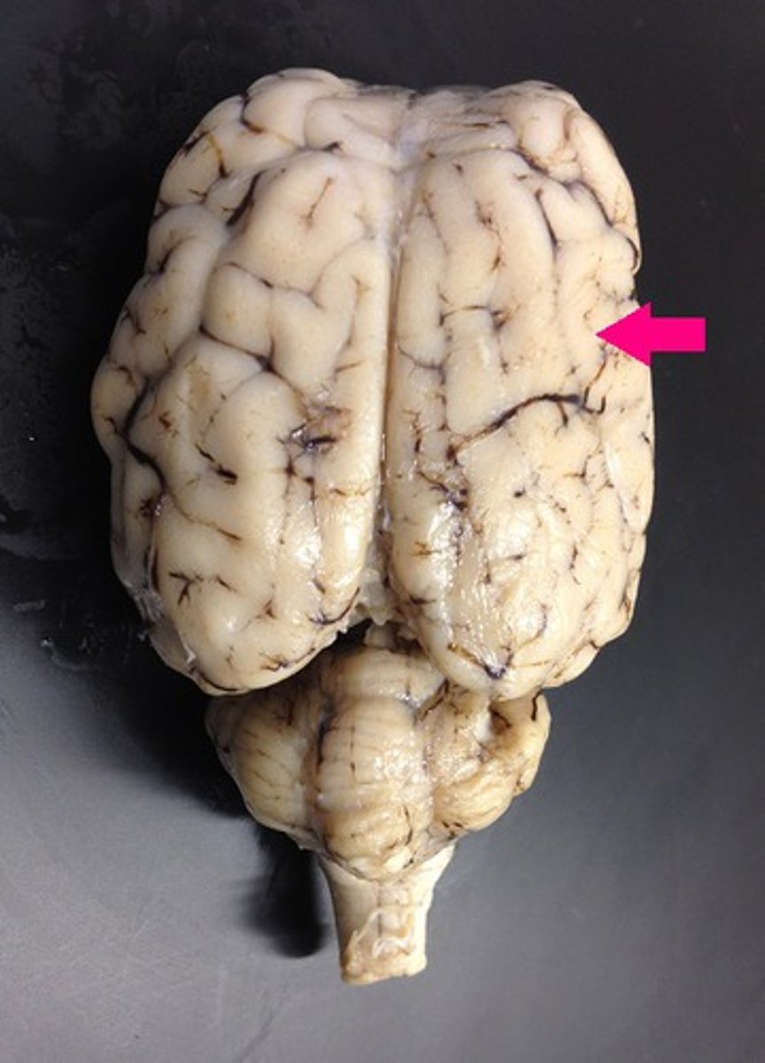 <p>Identify the major brain region.</p>