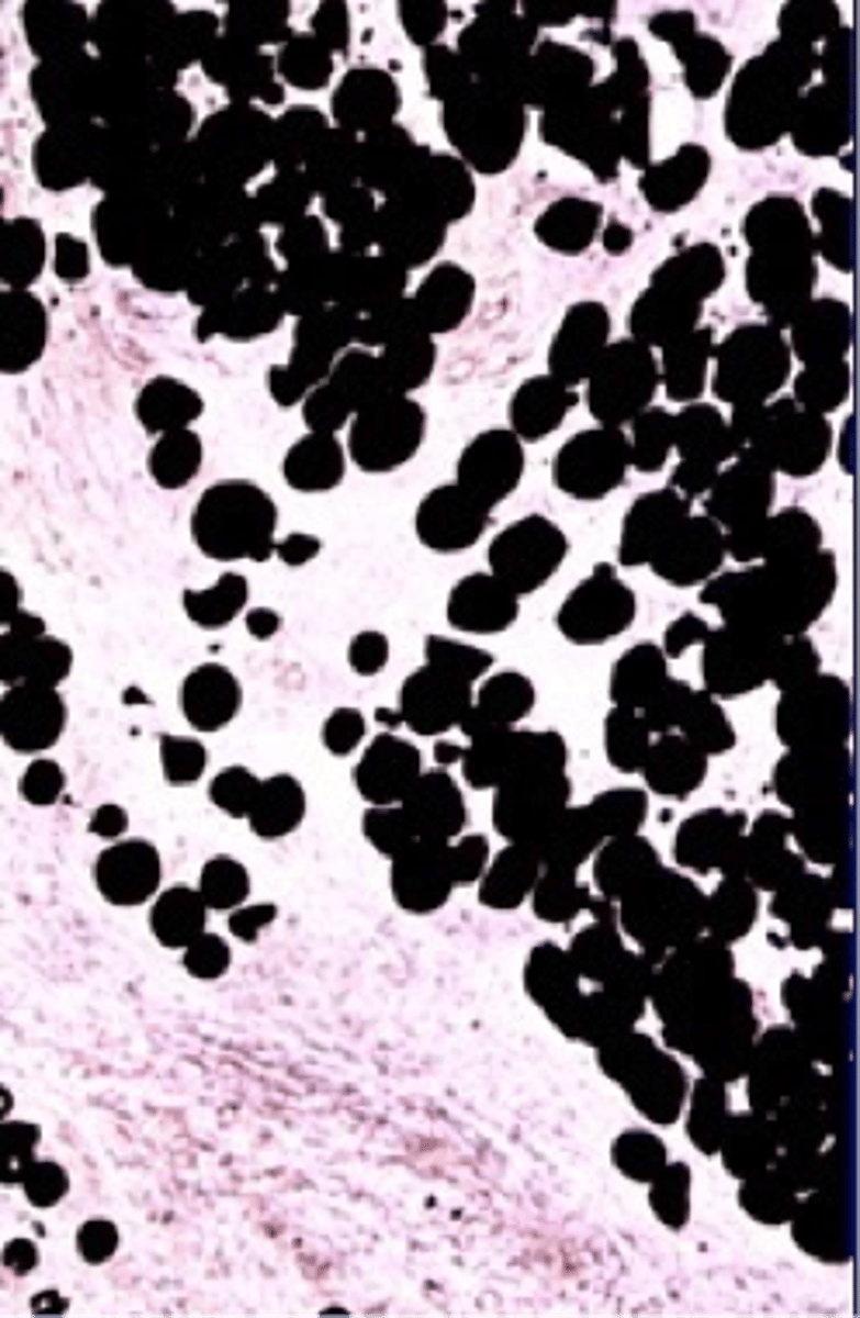 <p>A lipid-soluble dye staining lipids black.</p>