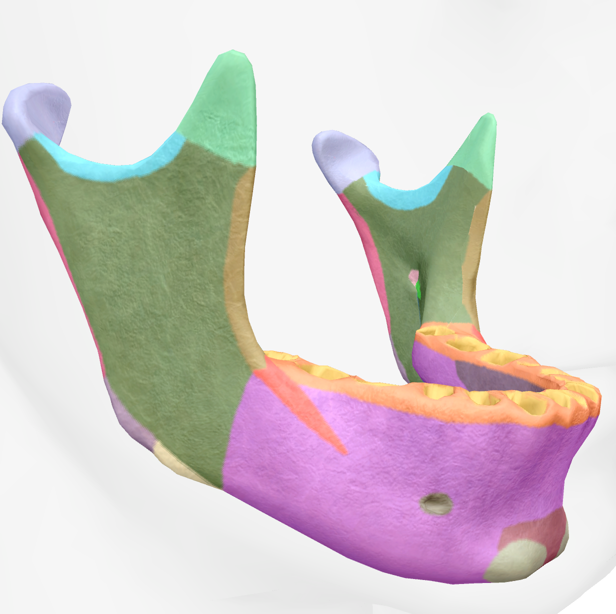 <p>divot between coronoid and condylar process of the ramus of the mandible </p>