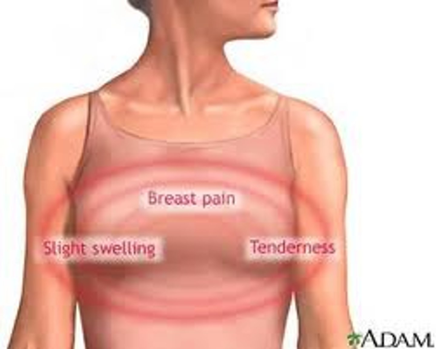 <p>pain in the breast</p>