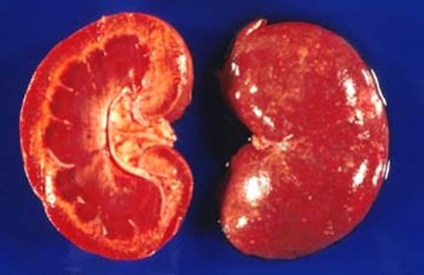 <p>kidney</p>