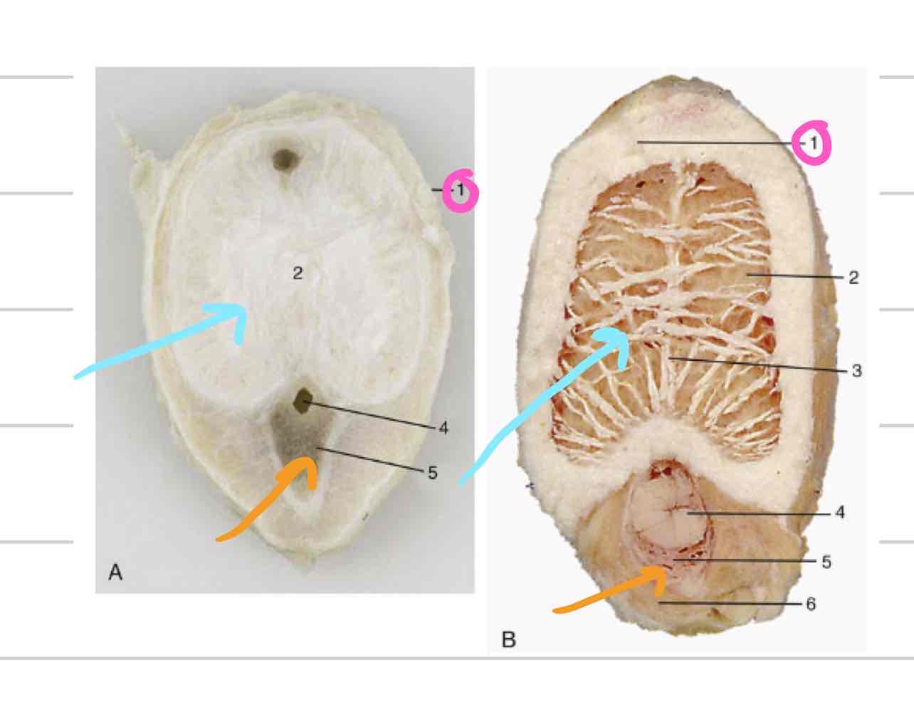 <ul><li><p>(Pink) tough outer casing that surrounds corpus cavernosum</p></li></ul>