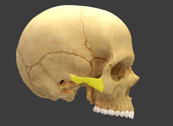 term image