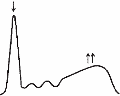 <p>What disease/ disorder is associated?</p>