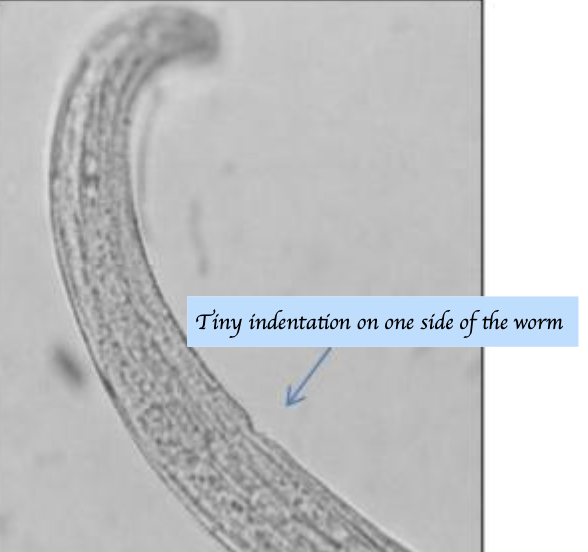<p><span><span>Which parasites are shown in this picture, and which morphological feature supports this conclusion?</span></span></p>