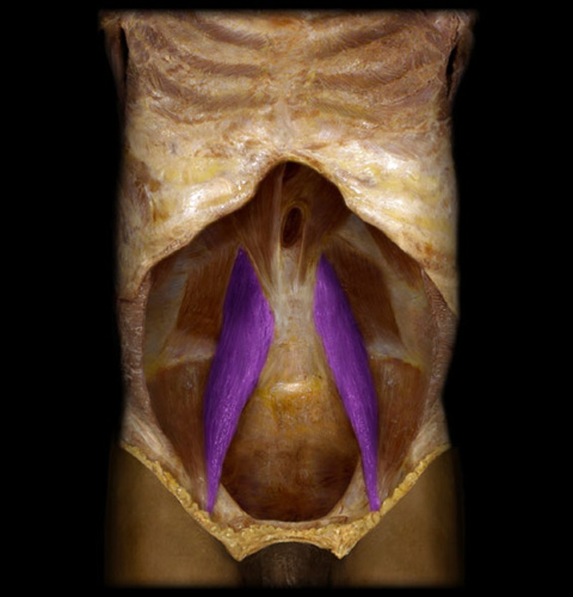 <p>O: L1-L5 vertebrae</p><p>I: lesser trochanter of femur</p><p>A: flex thigh</p><p>N: femoral</p>