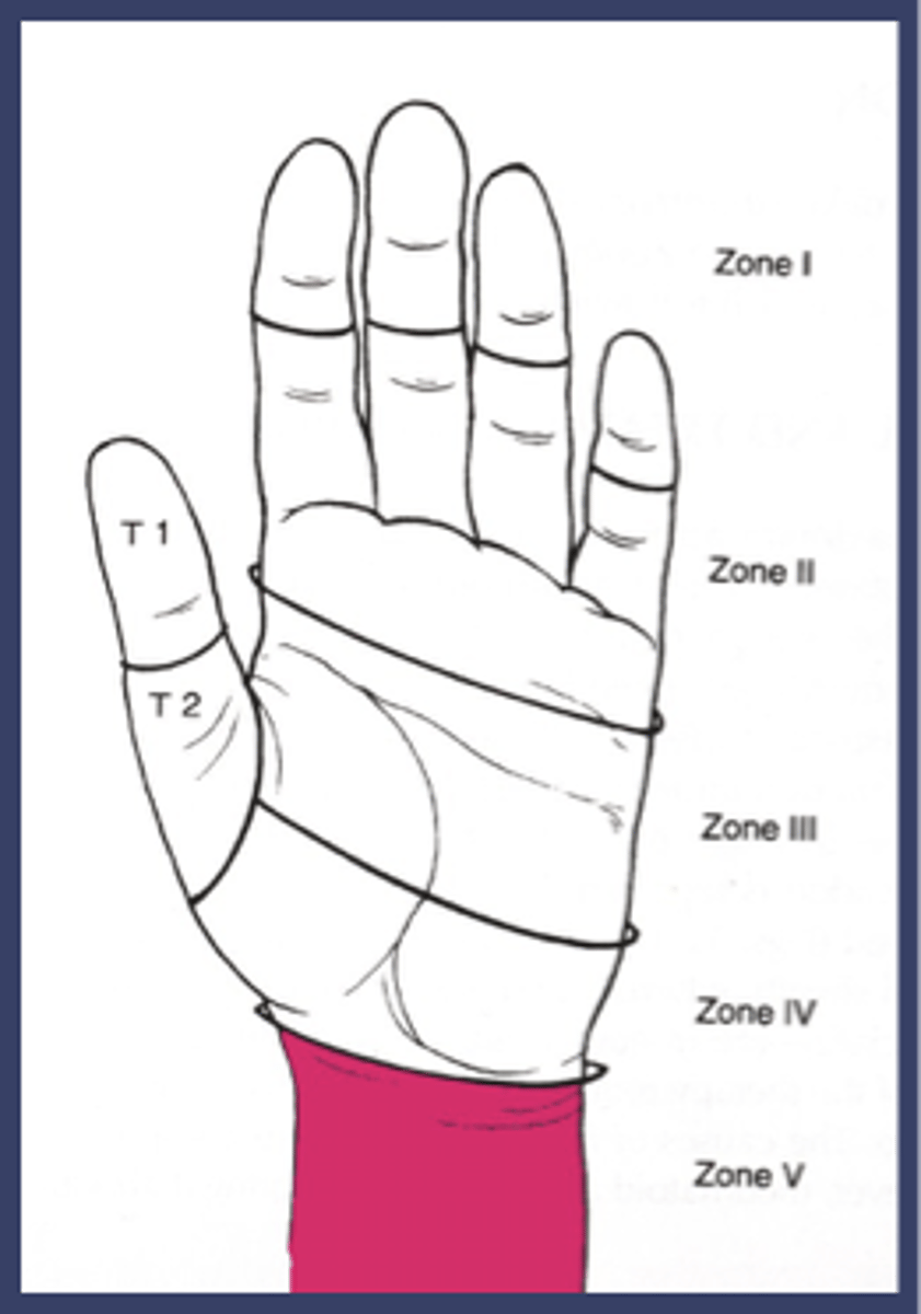 <p>wrist</p>