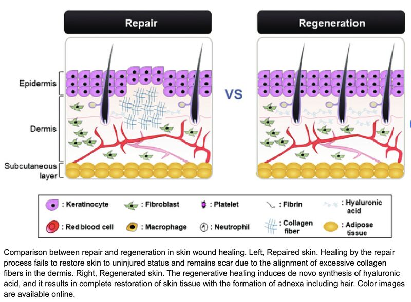 <p>regeneration, Fibrosis, type, severity, dense fibrous connective tissue(scar tissue), cannot, replacement, type, mitosis, glycoprotein, Fibronectin, attachment, repair, plasma, extracellular matrix</p>