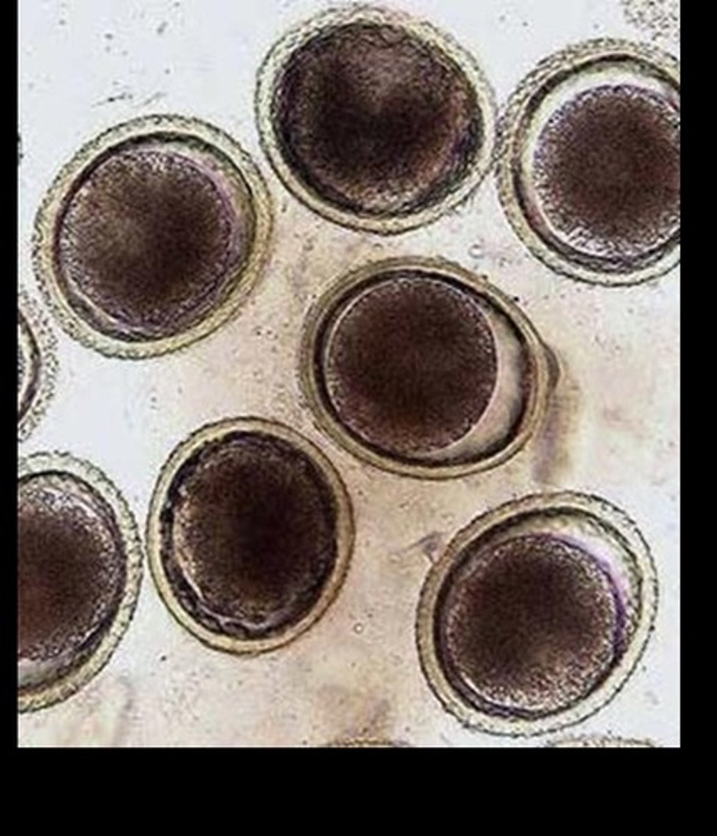 <p>By visualization of eggs in the fecal analysis (float and/or smear) or visible worms in the stool.</p>