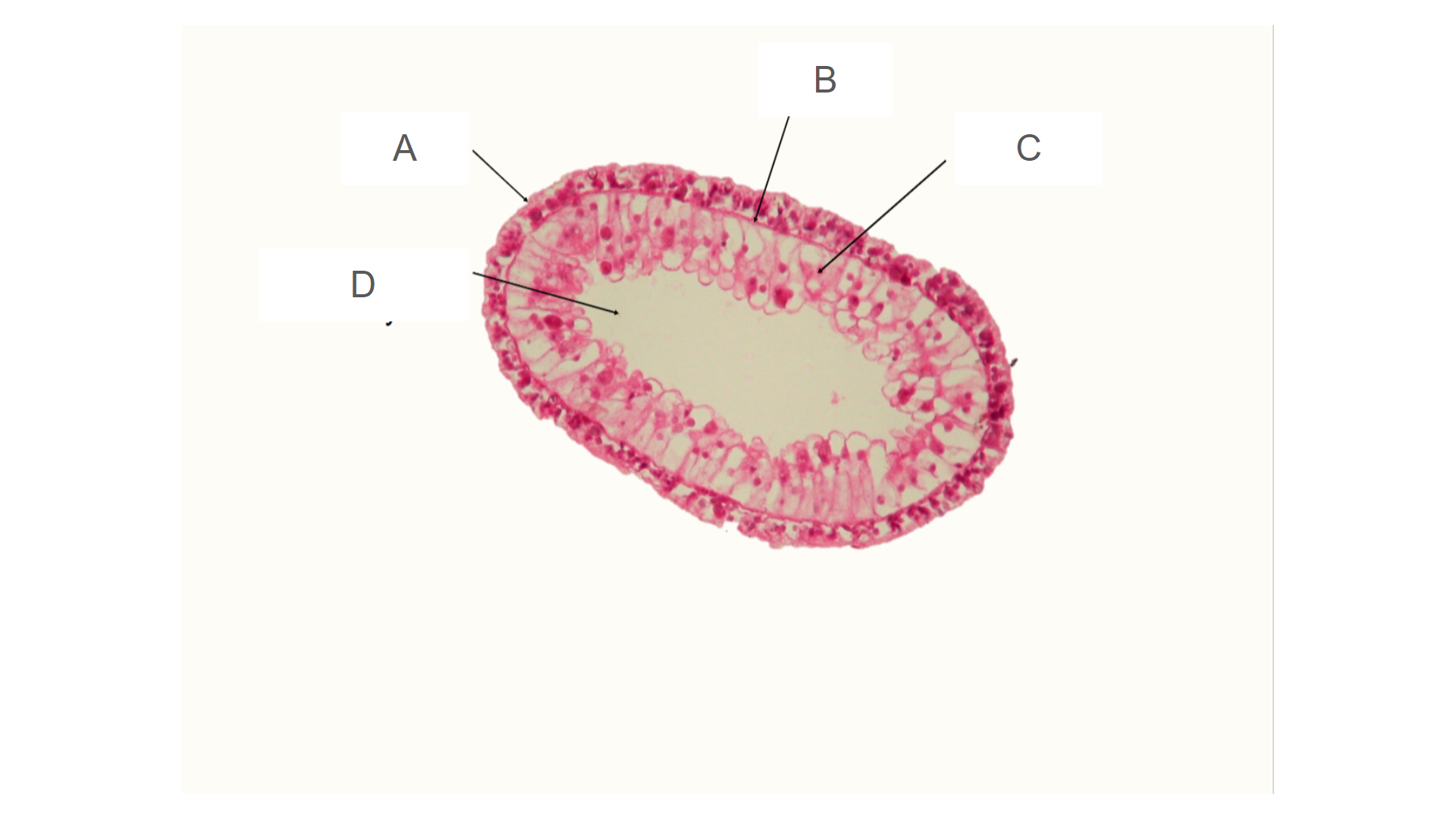 <p>What tissue layer is A?</p>