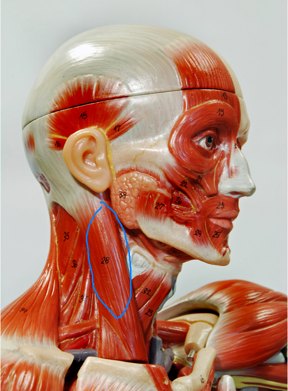 <p>What is the Name of the Muscle Circled? [28]</p>