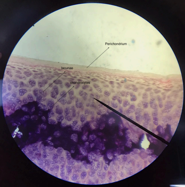 <p>matrix is predominated by glass-like ground substance called <strong>hyaline</strong>; scattered around the matrix are spaces called <strong>lacunae</strong>, and lodged between them are the <strong>chondrocytes</strong>; the connective tissue covering the cartilage is the <strong>perichondrium</strong></p>