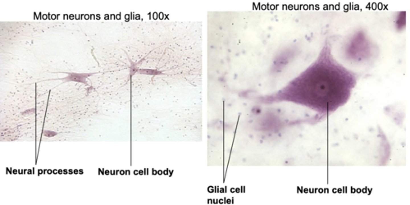 <p>neural processes.</p>