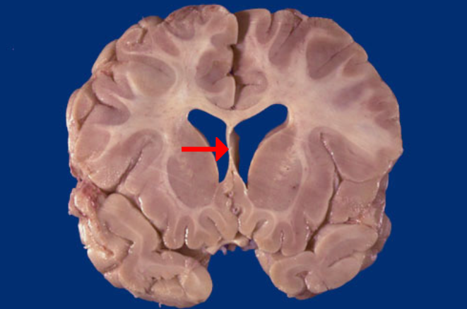 <p>Label this brain structure</p>