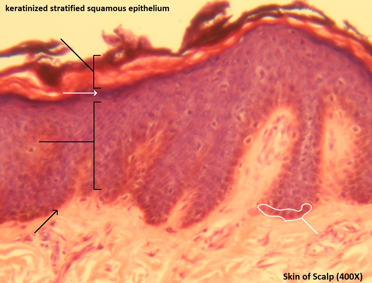 <p>Stratified Squamous Epithelium (Keratinized)<br>*surface cells are dead and full of Keratin</p>