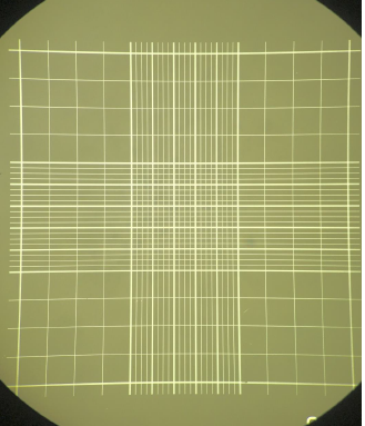 <p>What condition indicates the use of the counting area seen in the photo in the manual WBC count procedure?</p>