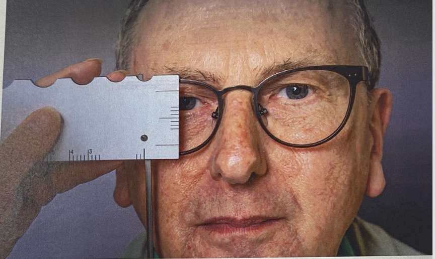 <p>The patient should be fitted with the frame to be glazed, correctly adjusted. Use the scale along the short edge on the back of the gauge. Place this scale vertically before the eye, to the temporal side of the pupil. Keep the extreme horizontal lines on the scale parallel with, and equidistant from, the top and bottom rims of the frame in order for the central scale line to locate the CL. The segment top position can now be measured from the HCL using the short scale lines, which are in 2mm steps.</p>