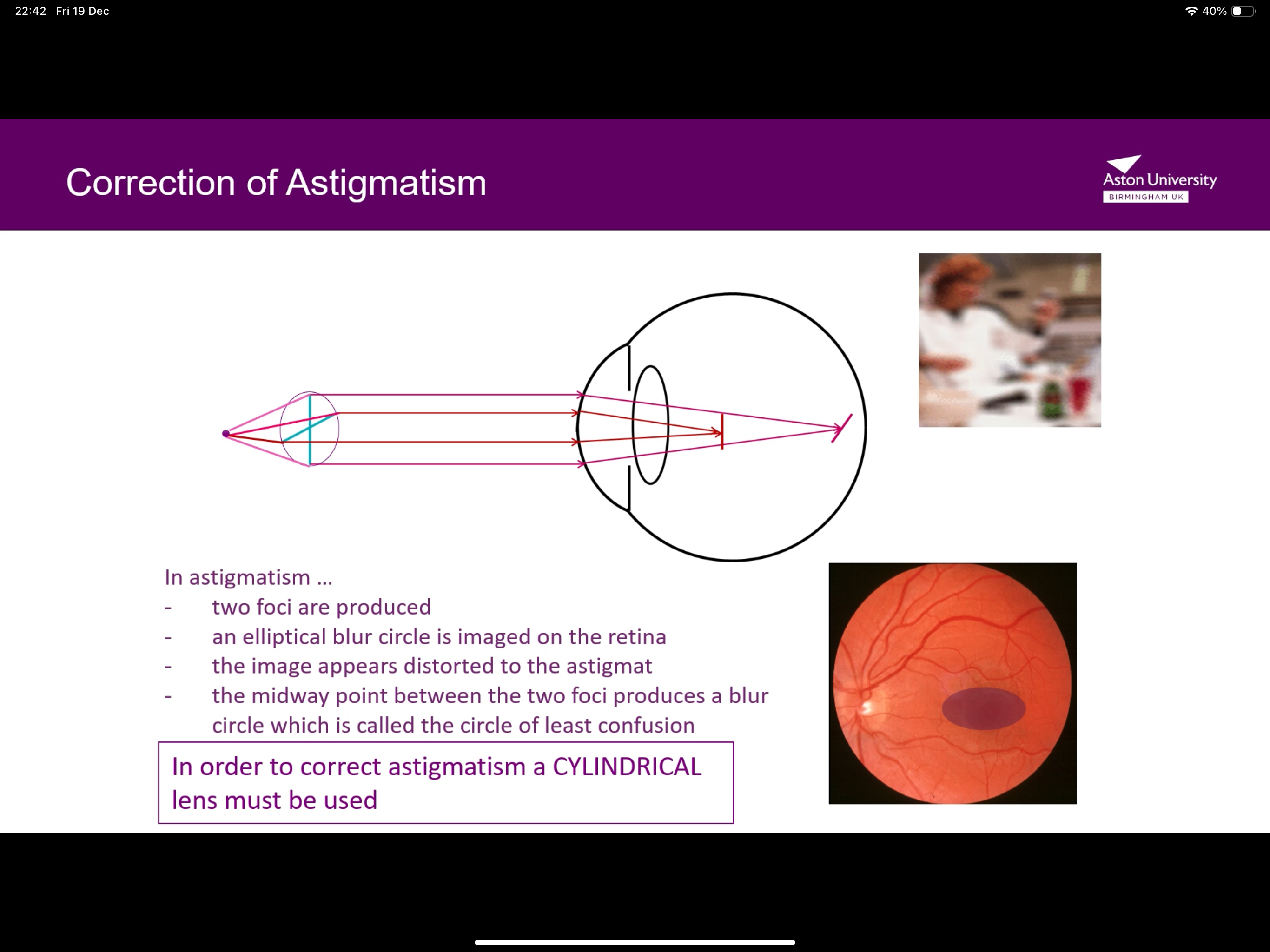 <p>2 foci are produced, as an elliptical blur circle is imaged on retina and the image appears distorted </p>