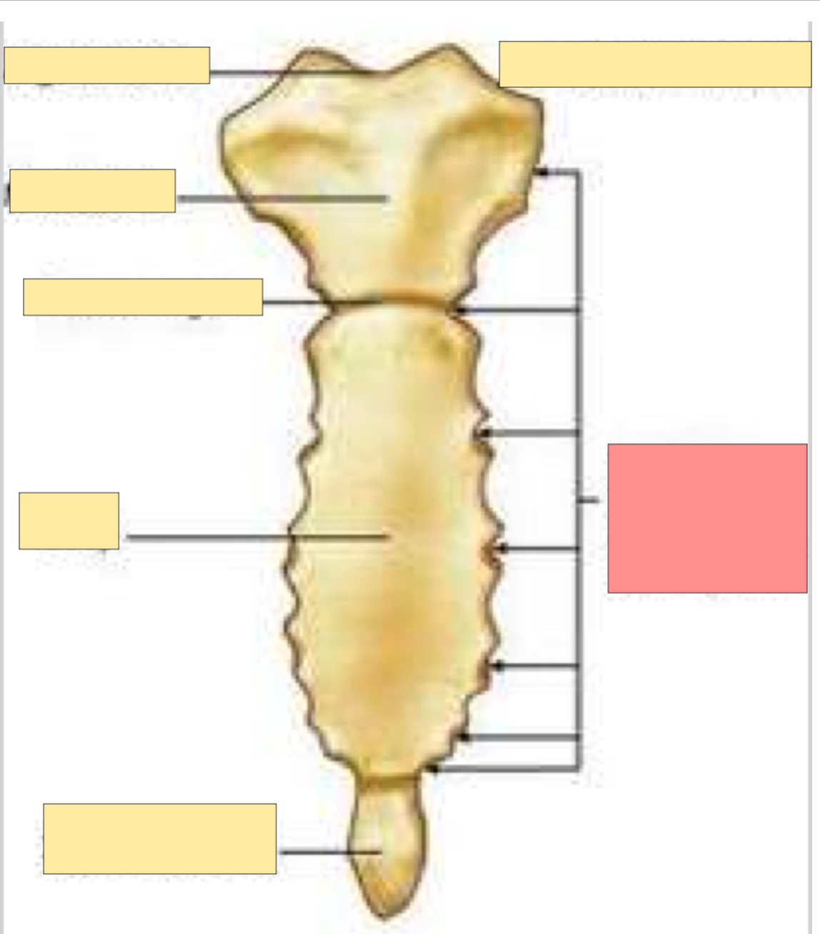<p>What part of the sternum is this?</p>
