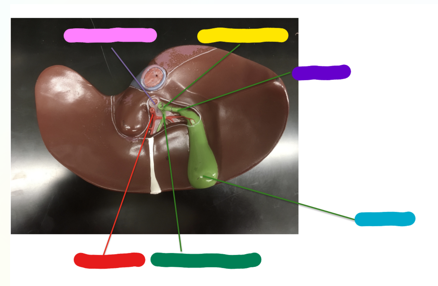 <p>What is indicated by the Yellow Section?</p>