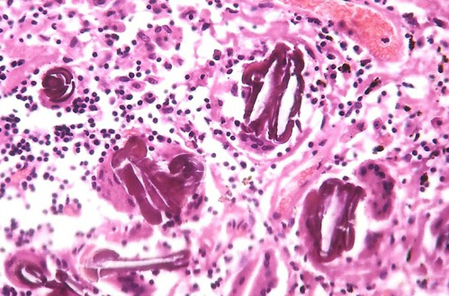 <p>A steroid that is an important component of animal cell membranes and that acts as a precursor molecule for the synthesis of other steroids such as hormones.</p>